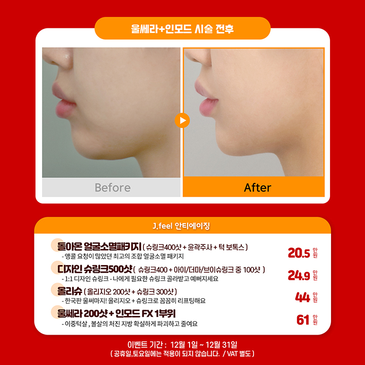 예뻐지는 홍대피부과 타임이벤트 12월의 해피아워 관련 이미지 3