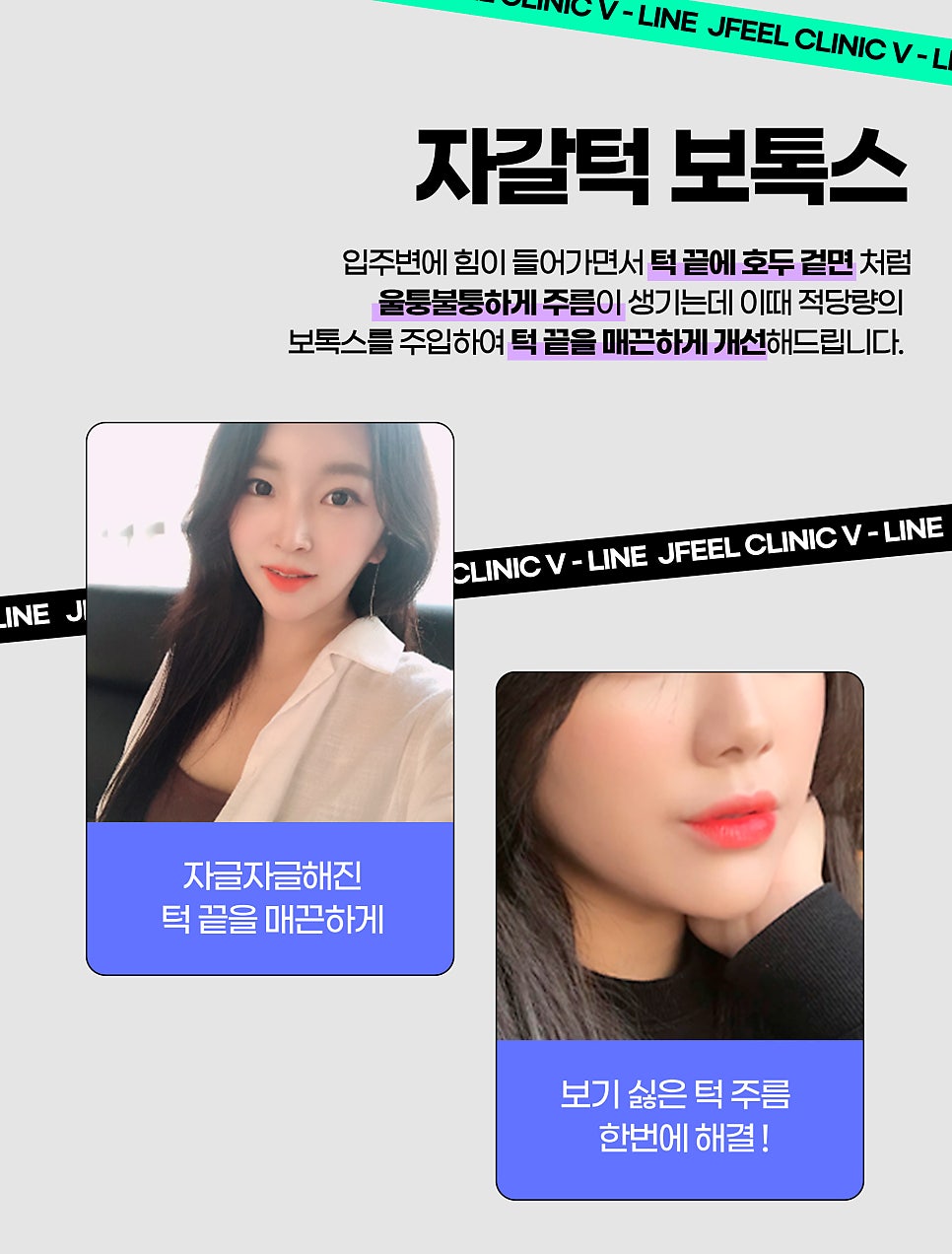 턱주사, 무턱 이중턱 자갈턱 모두 가능 관련 이미지 5