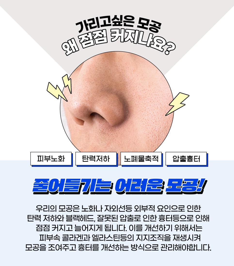 모공없애기, 제오민과 LDM으로 가능 관련 이미지 2