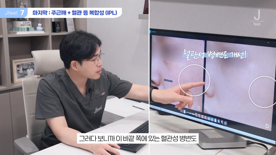 기미 주근깨 잡티에 이 시술만은 NO! 시술 전 필독 관련 이미지 15