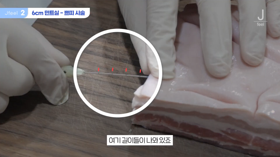 민트실을 돼지고기에 넣는다면? 실리프팅 실험 관련 이미지 8