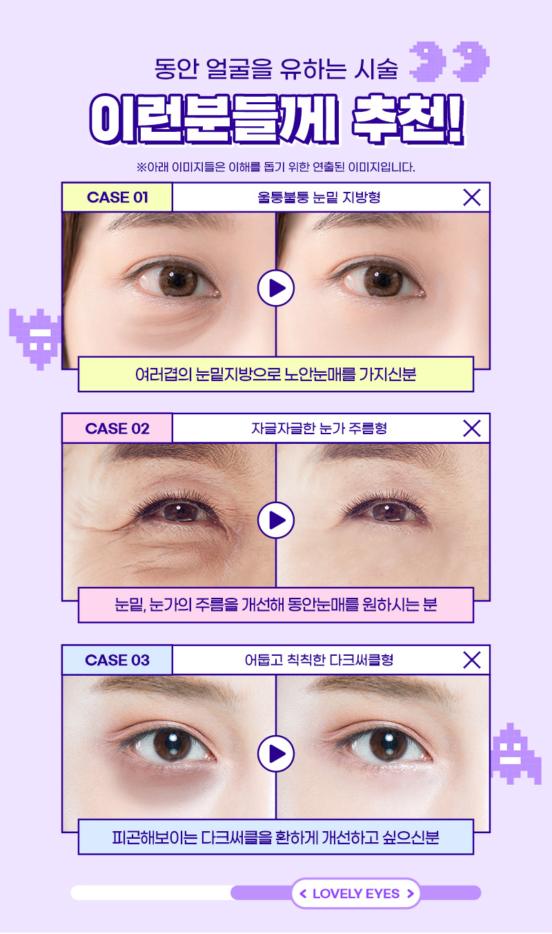 눈가주름제거, 잔주름, 퀭한 눈, 처진 눈 맞춤 케어 관련 이미지 7
