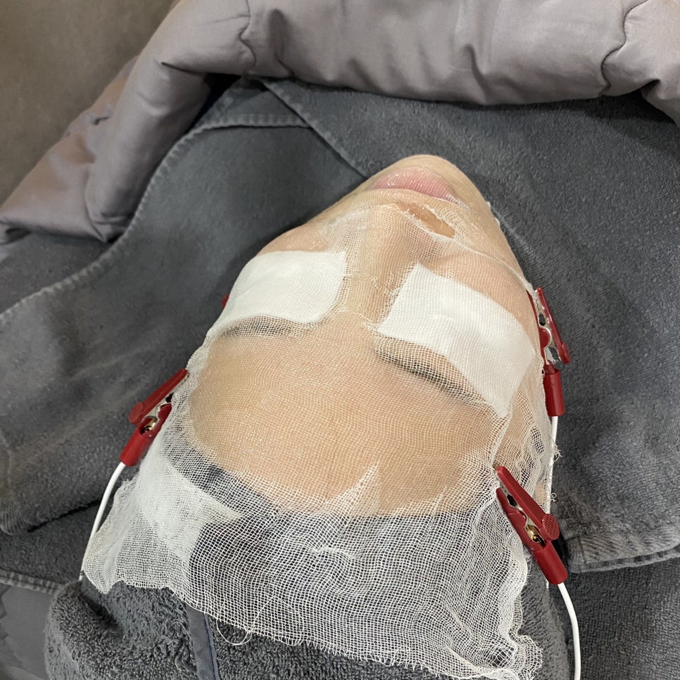 마스크트러블고민엔 피부과앰플로 충전하고 재생크림으로 회복시키세요 관련 이미지 5