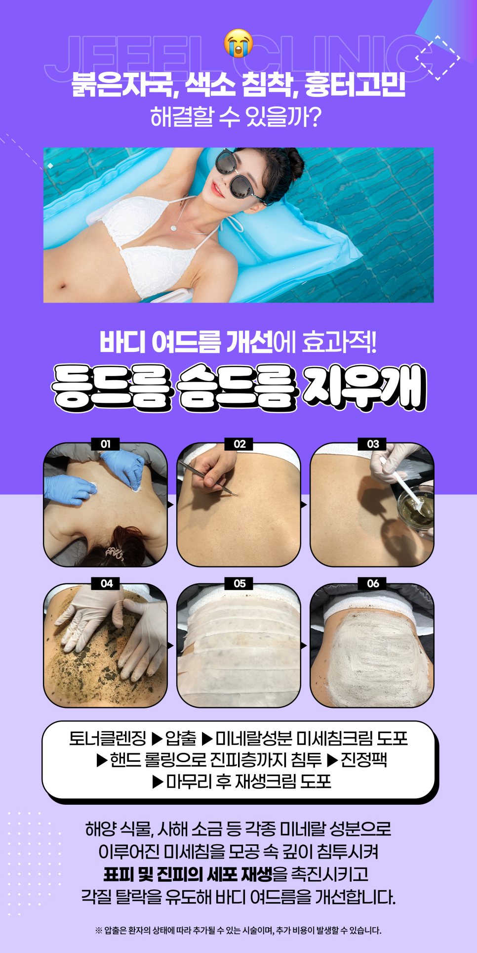 등드름가드름, 여름 되기 전에 없애자 관련 이미지 4
