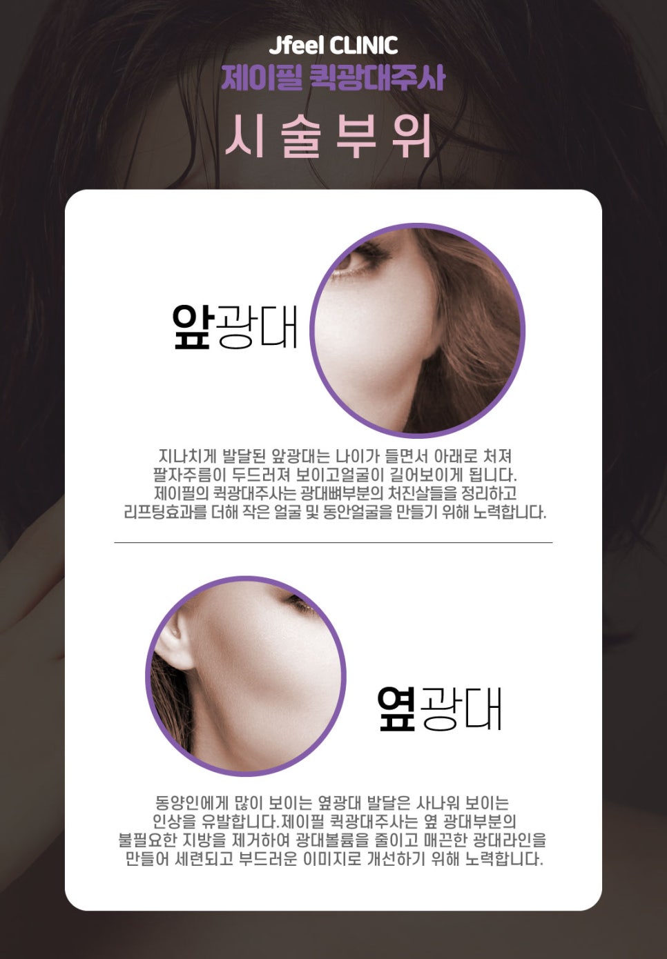 앞,옆광대축소에는 광대윤곽주사로 고민해결해보세요 관련 이미지 6