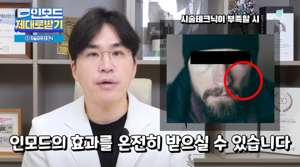 인모드효과 못 보셨다면 여기로 관련 이미지 15