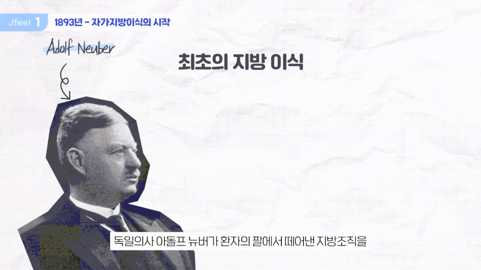 얼굴 필러 언제부터 시작됐을까? 필러 기간, 부작용 관련 이미지 4