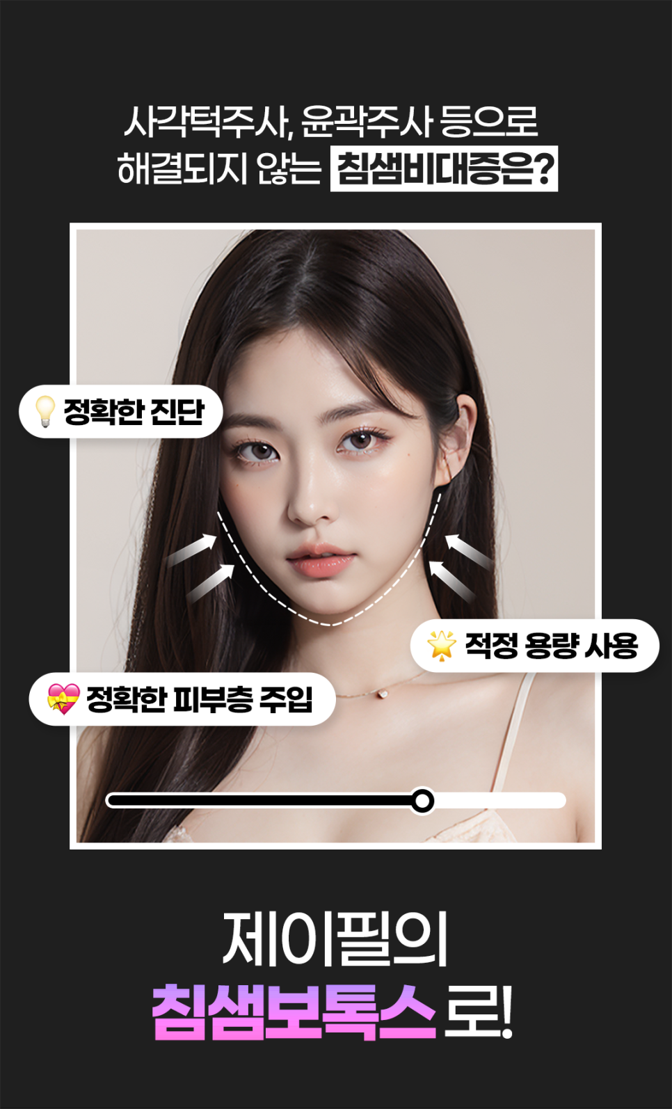 침샘보톡스로 작은 얼굴 만들기 관련 이미지 6