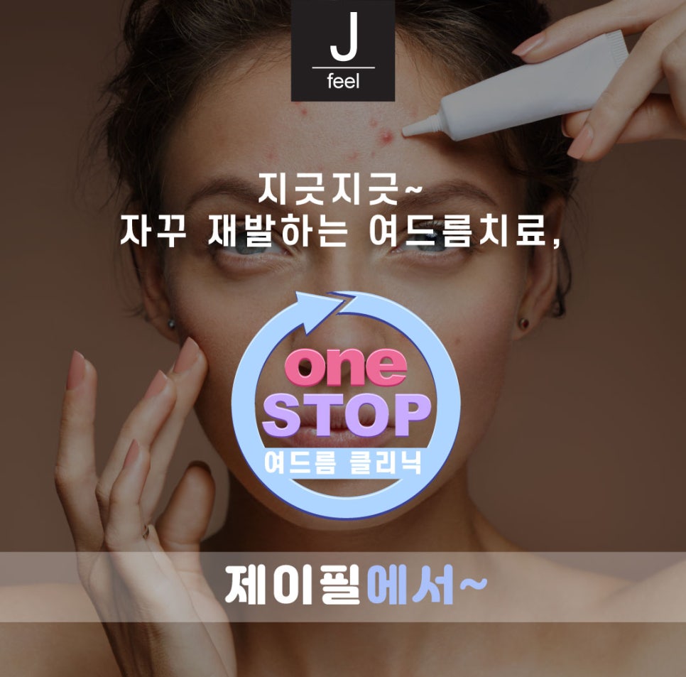 여드름과 흉터 개선에 도움을 주는 치료 방법 관련 이미지 4