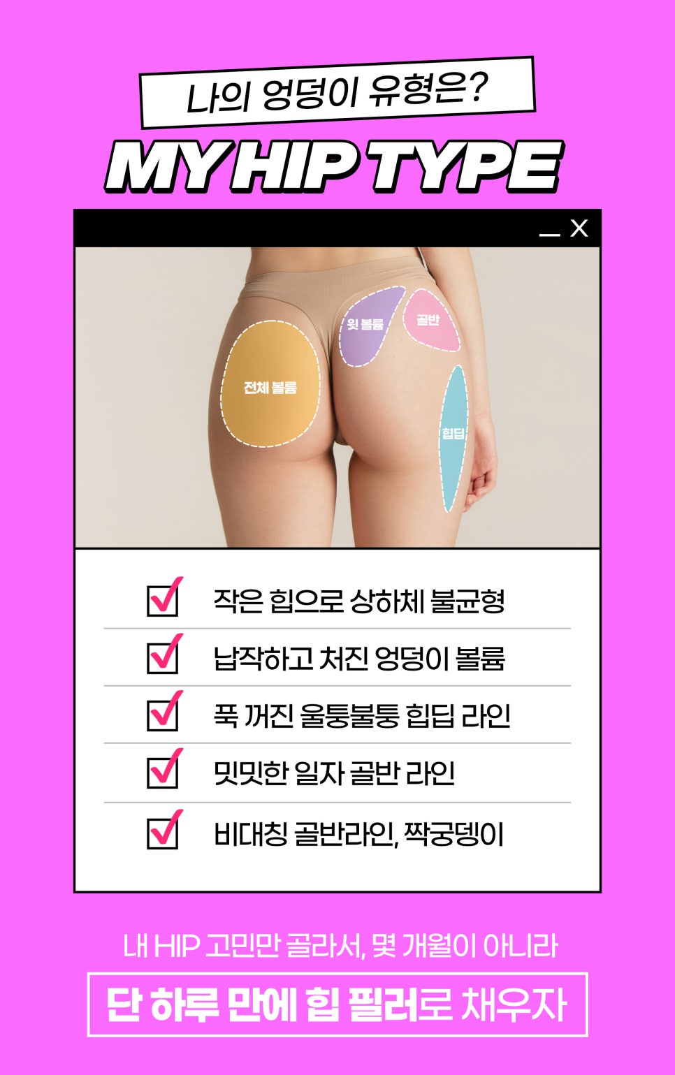 볼륨빵빵 애플HIP만드는 HIP프팅, 엉덩이필러 관련 이미지 6