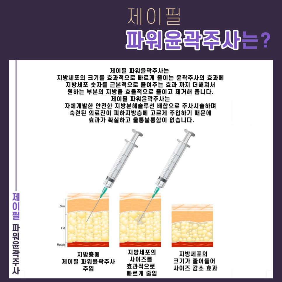 [홍대피부과] 옆광대도 이중턱도 제이필 홍대윤곽주사 관련 이미지 2