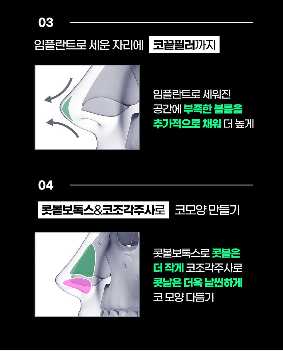 코끝시술, 제이필 코끝창조로 더 높게! 관련 이미지 7