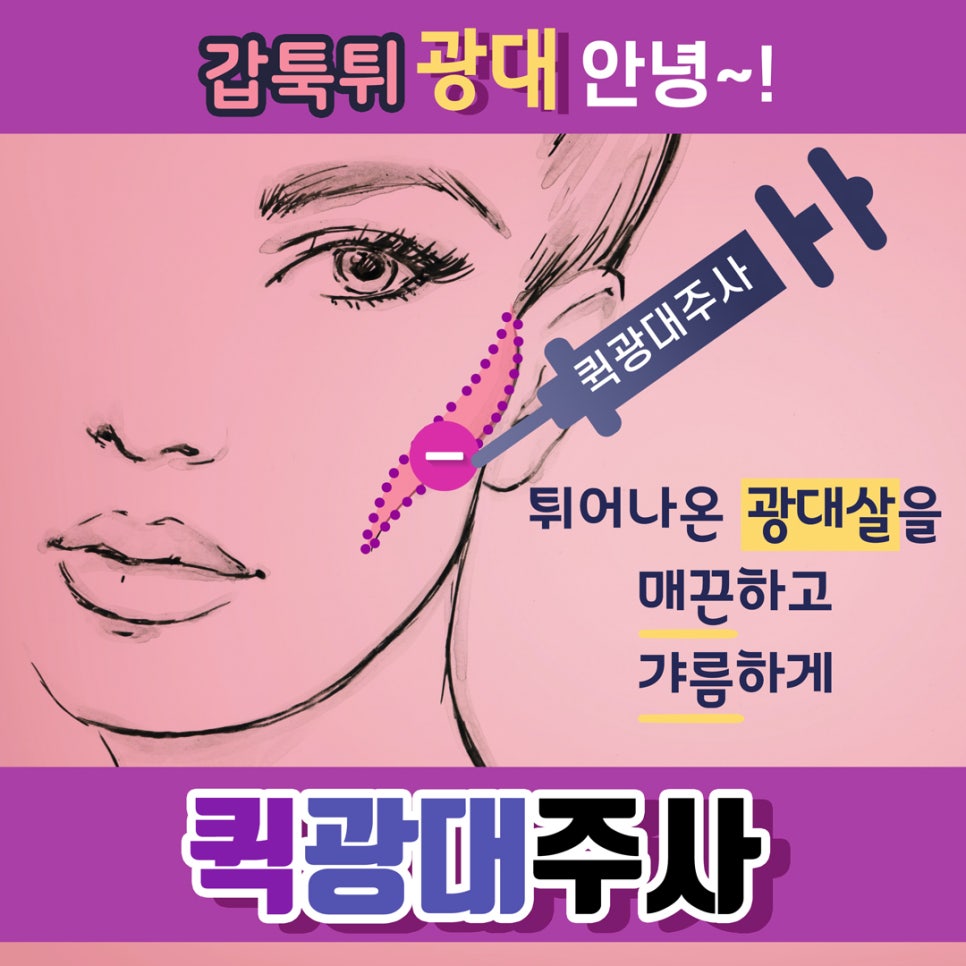 [홍대피부과] 수술없이 광대축소  "퀵광대주사" 관련 이미지 1
