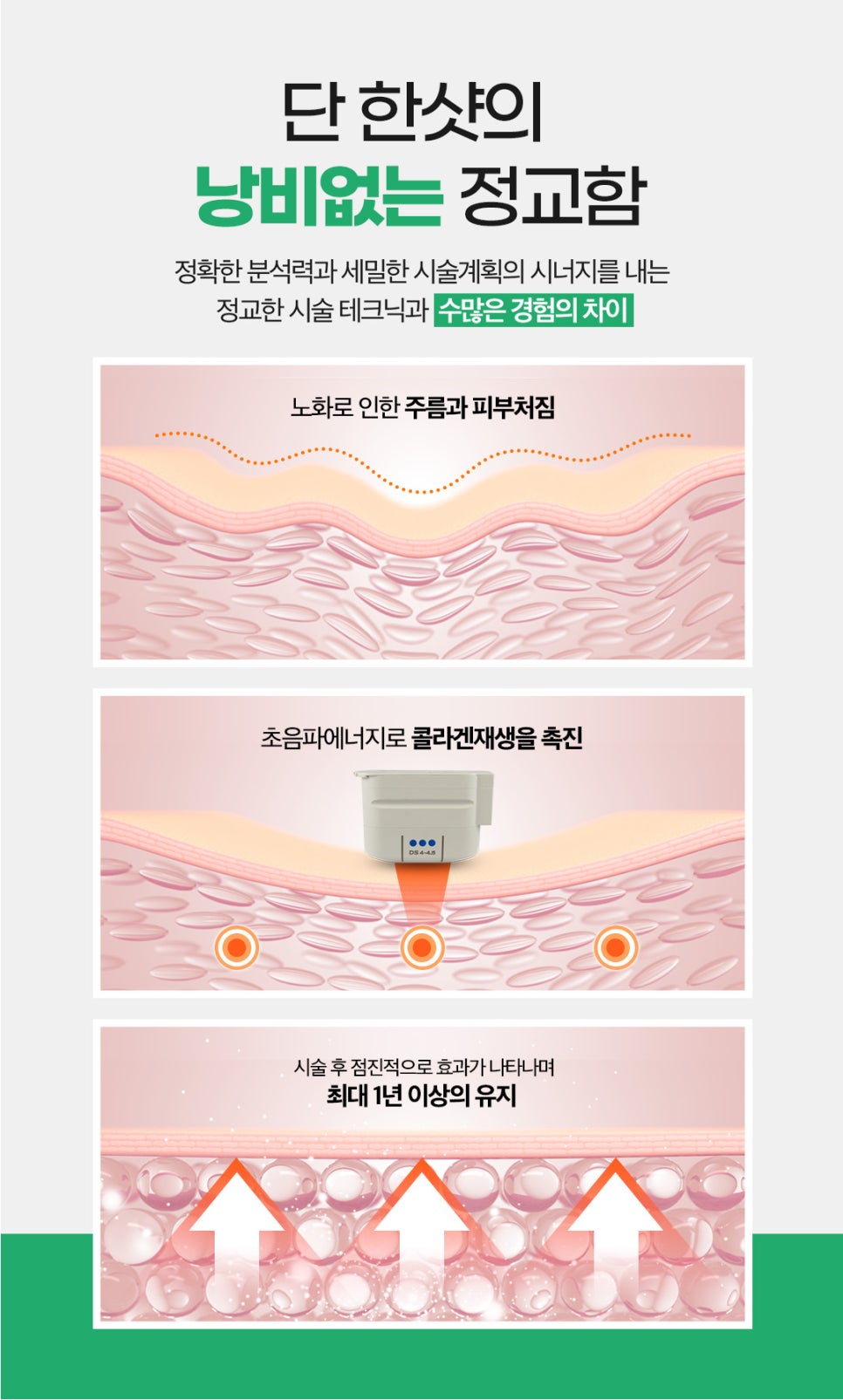 얼굴주름관리, 1년 프리패스로 가능 관련 이미지 7