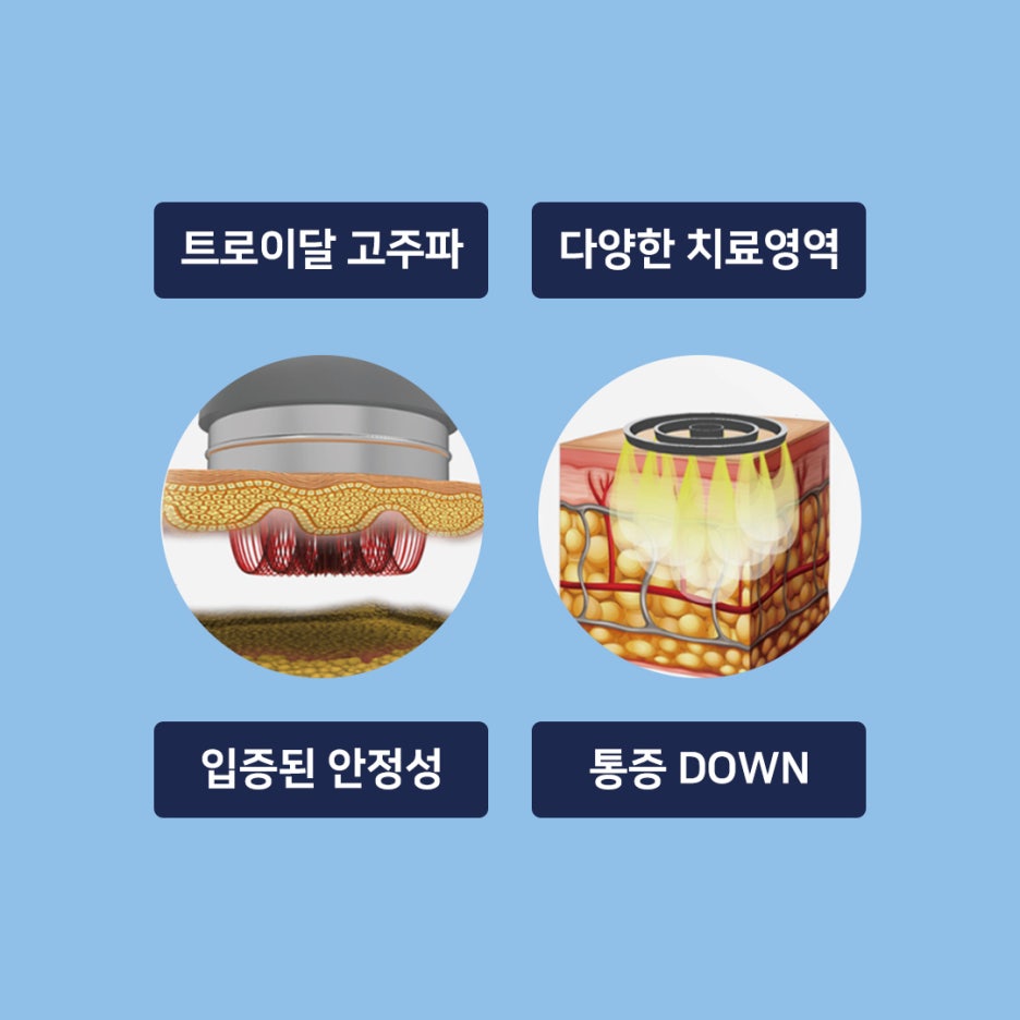 고주파마사지 바디땡김이로 바디리프팅과 지방분해 동시에! 관련 이미지 4