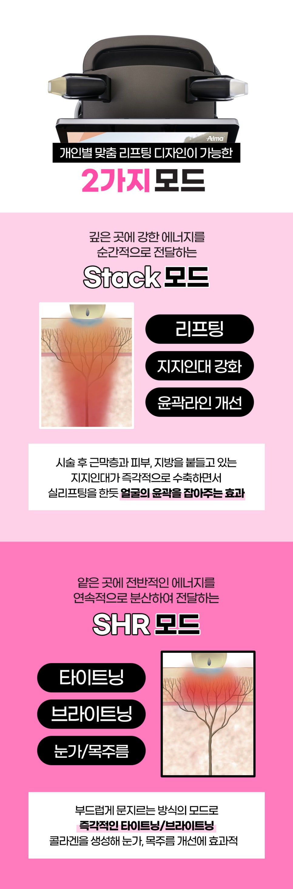 얼굴작아지는시술, 티타늄 V리프팅 관련 이미지 4