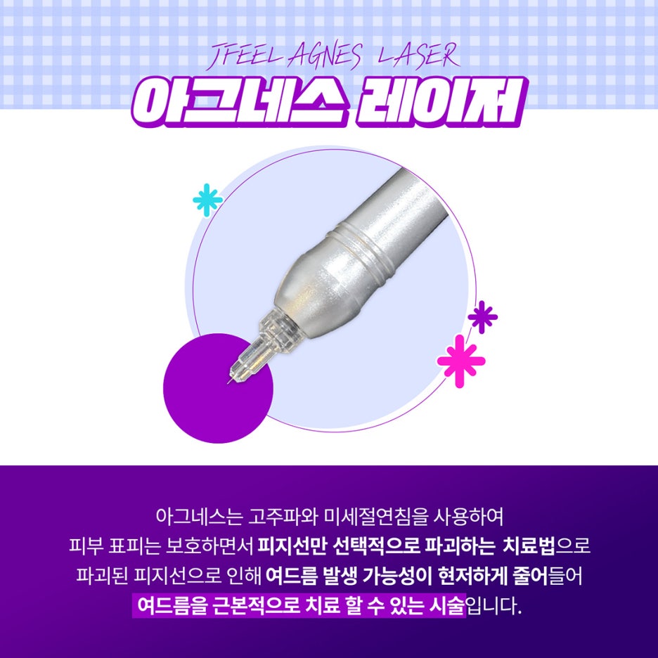 마드름 끝장내기? 제이필 마그네스 이벤트로! 관련 이미지 10