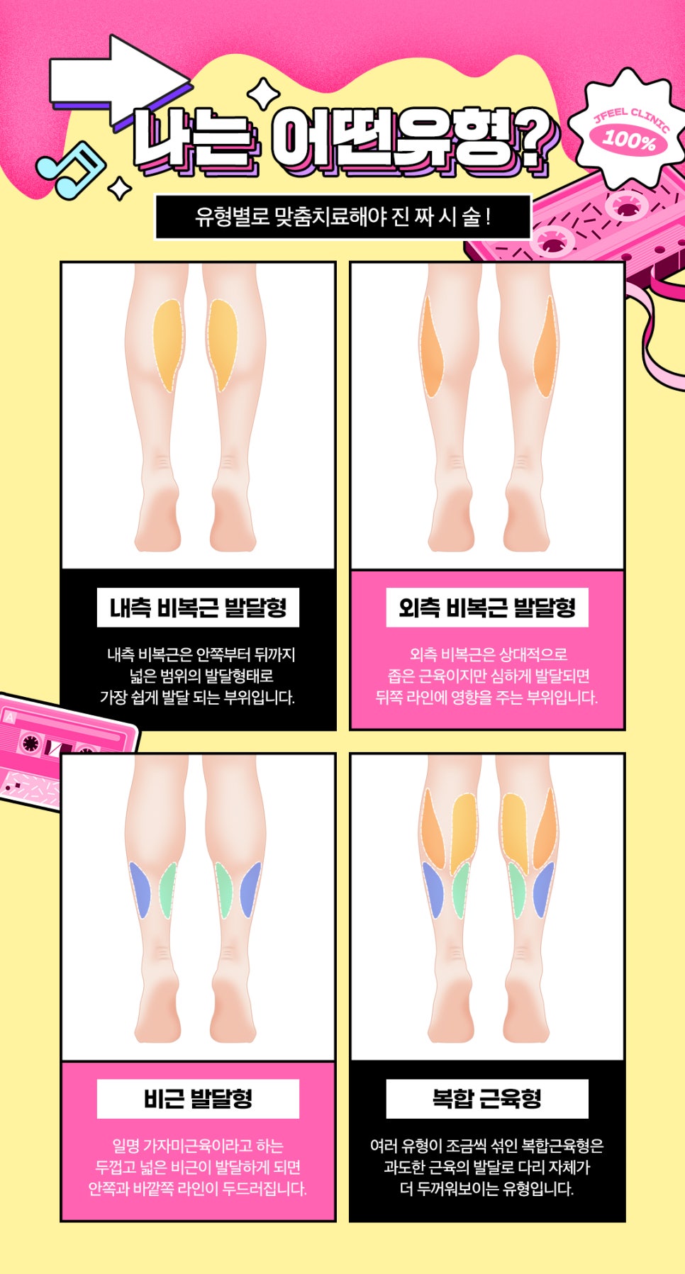 종아리알빼고 하체비만 탈출! 날씬한 다리만들어요 관련 이미지 3