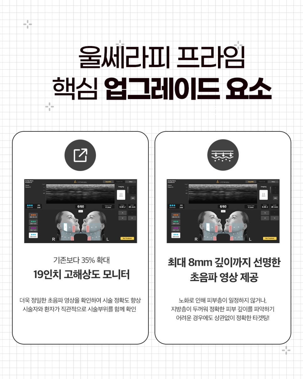 Hongdae Entrance Station Dermatology: Which Is Better, Ulthera Prime or Ulthera? image 4