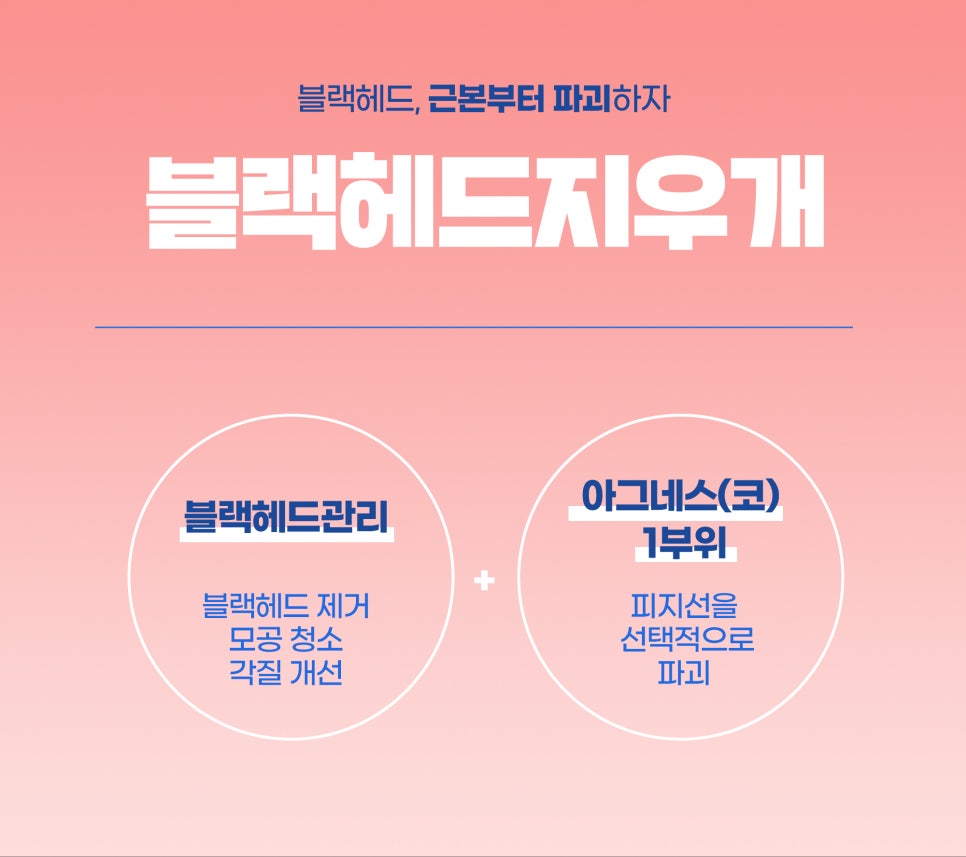 블랙헤드관리, 모공 속 피지 관리가 우선 관련 이미지 3