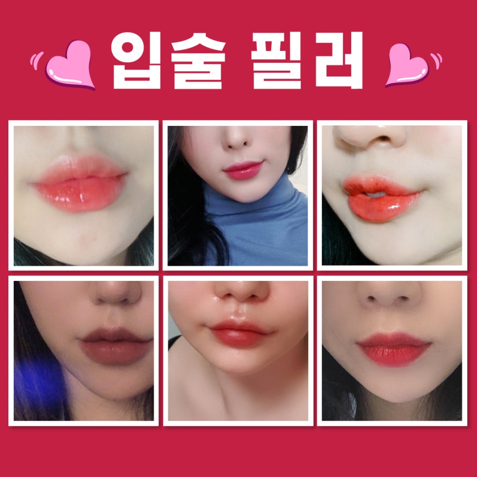 홍대피부과, 키스데이맞이 입술필러 이벤트 관련 이미지 5