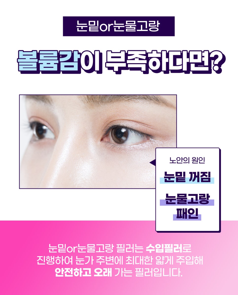 홍대필러로 꺼진 부위 채우고 싶다면 관련 이미지 4