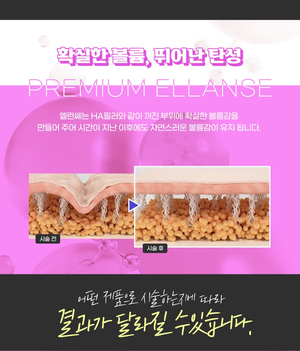 엘란쎄필러, 프리미엄 콜라겐 부스터 관련 이미지 3