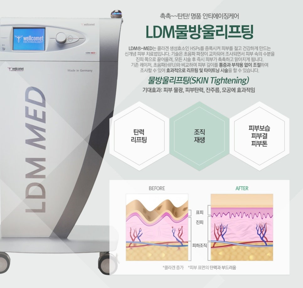[홍대피부과] 올 여름, 제이필만의 홍조 관리 끝판왕 관련 이미지 2