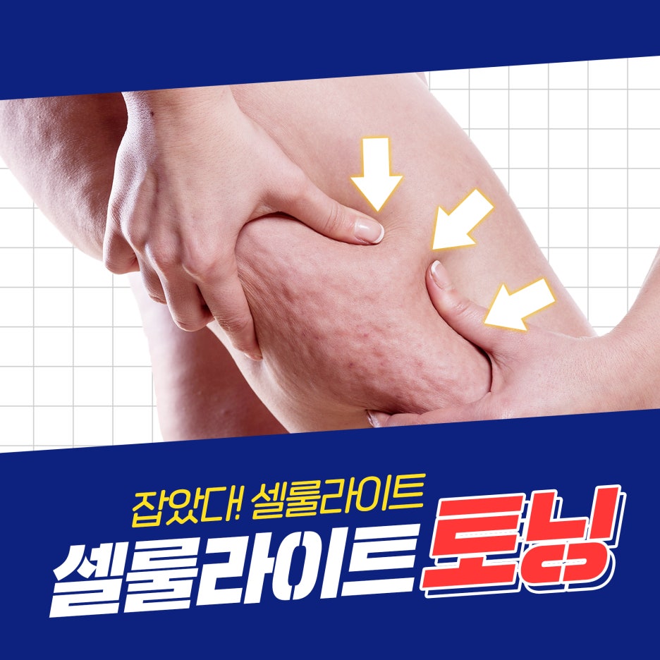 잡았다! 셀룰라이트 없애는 법, 제이필 셀룰라이트 토닝으로! 관련 이미지 1