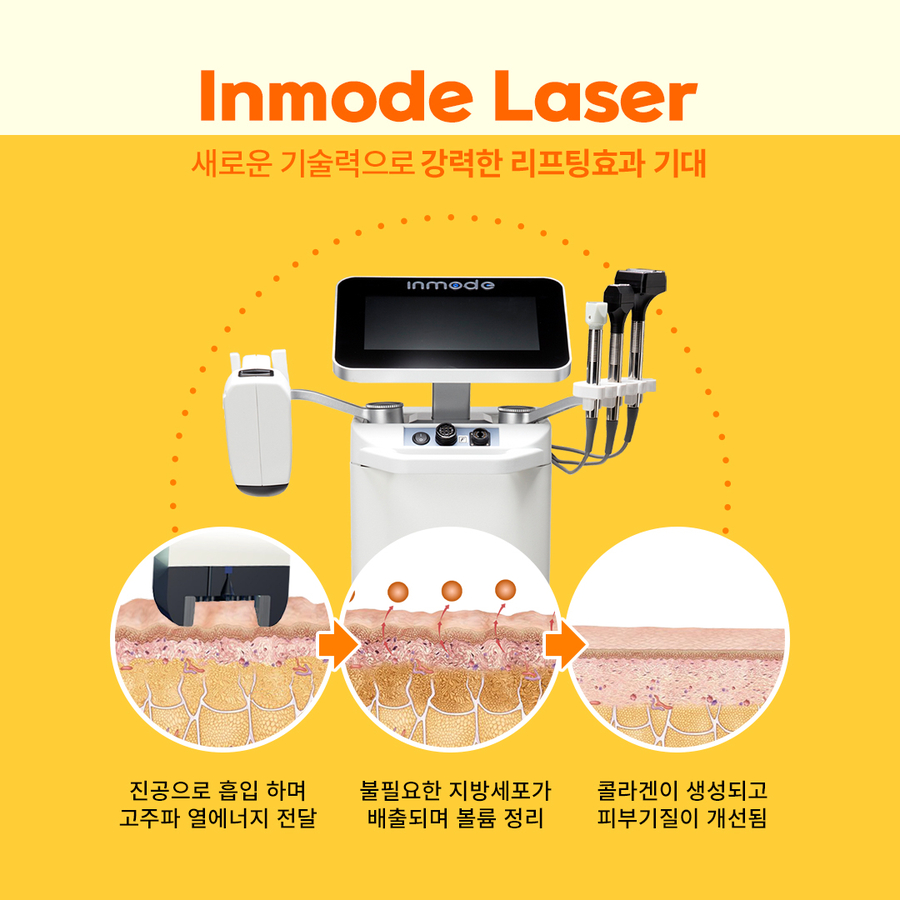 인모드,울쎄라를 이용한 리프팅 시술시 효과와 주의사항 관련 이미지 6