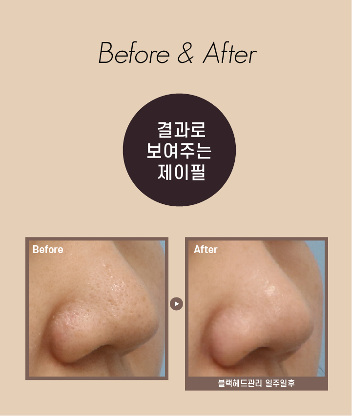PHA관리, 광채케어 물톡스필로 수분촉촉 관리해보세요 관련 이미지 9