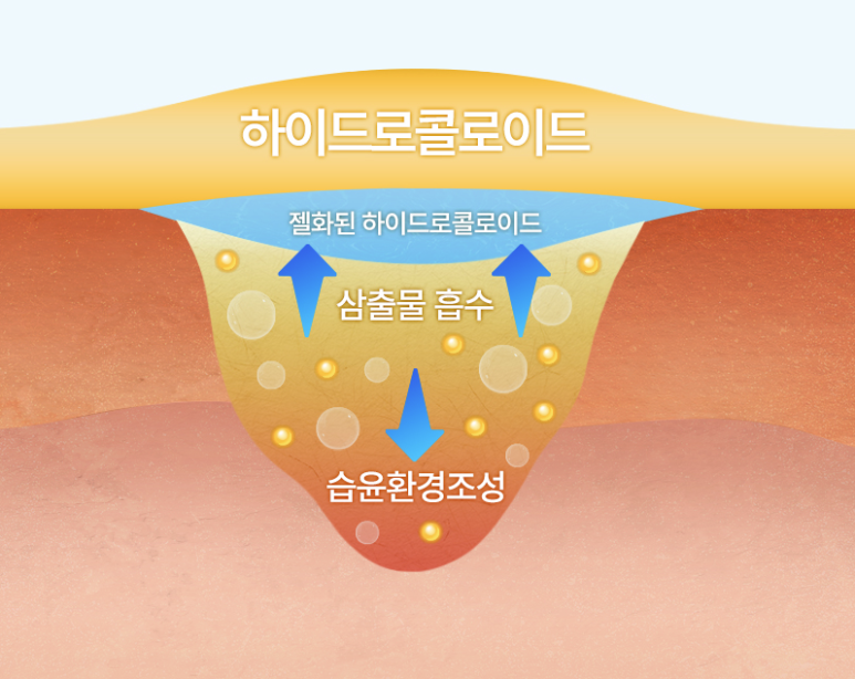 Post-Removal Care for Moles, Thread Lifting, and Fillers | Proper Use of DuoDerm image 5