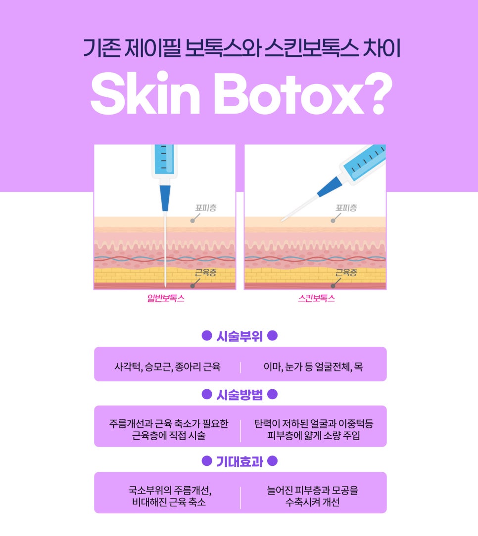 이마관리, 도자기이마 만드는 단 한 가지 방법 관련 이미지 2