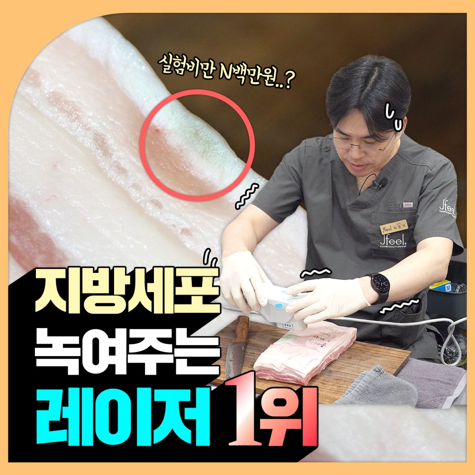 지방레이저가 얼굴 지방을 얼마나 녹일 수 있을까? 관련 이미지 1