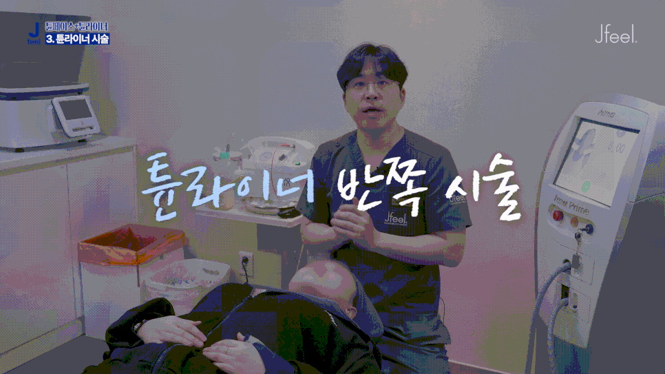 튠라이너 & 튠페이스 시술, 어떤 효과 있을까? 리프팅 + 탄력 관련 이미지 6