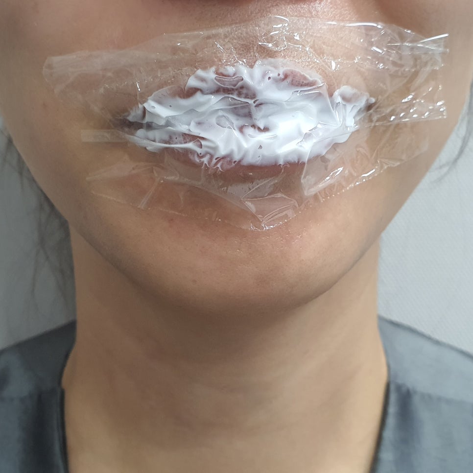 입술필러 맞고 조심해야 할 점, 주의사항, 통증, 붓기 관련 이미지 7