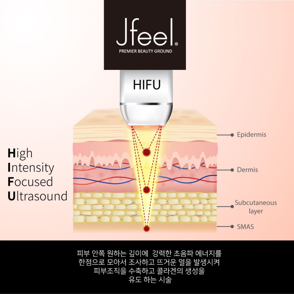 울쎄라, 슈링크 차이와 병원 선택 팁! 관련 이미지 3