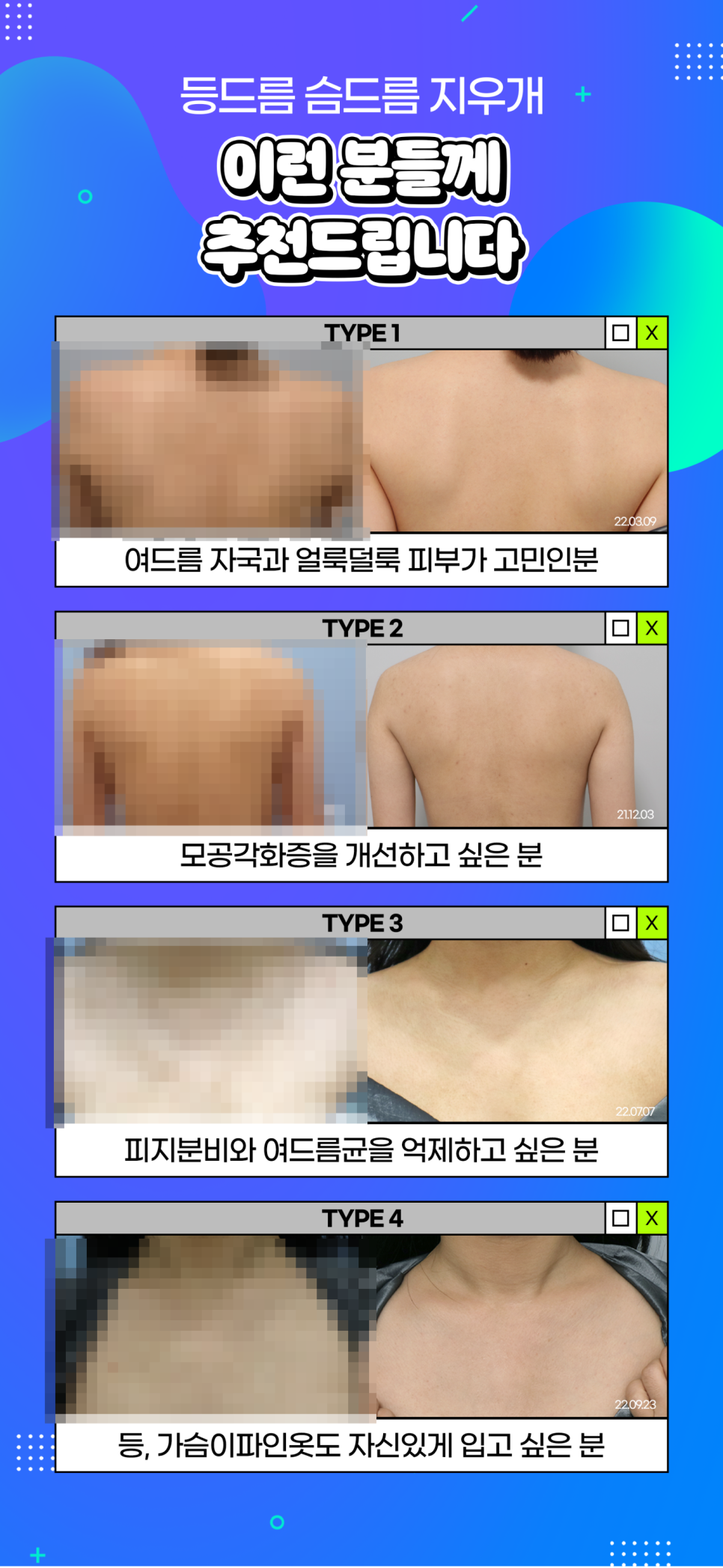 등드름가드름, 여름 되기 전에 없애자 관련 이미지 6