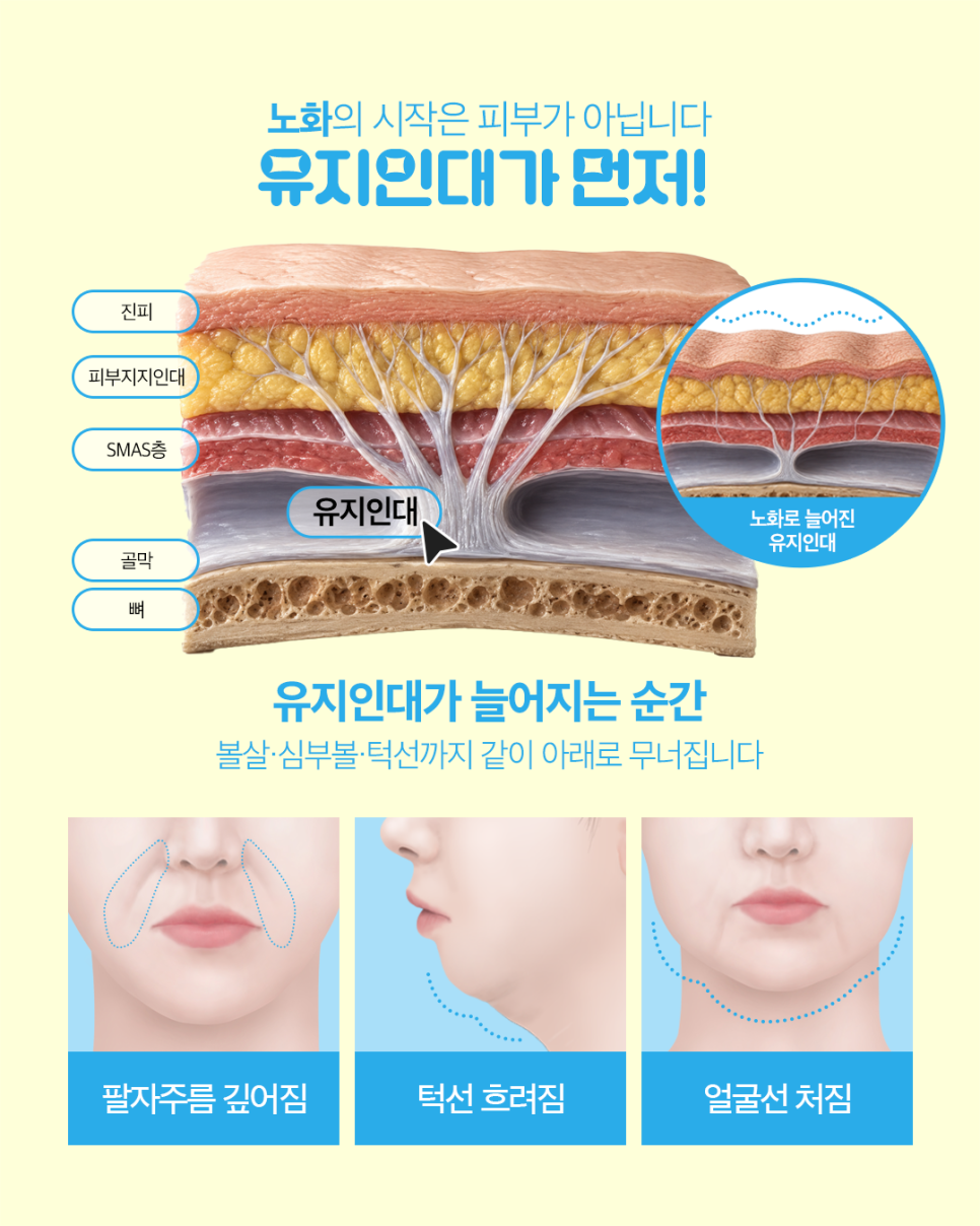 울쎄라 써마지 온다 차이 뭘까요? 피부 두께별 추천 리프팅 선택 총정리 관련 이미지 5