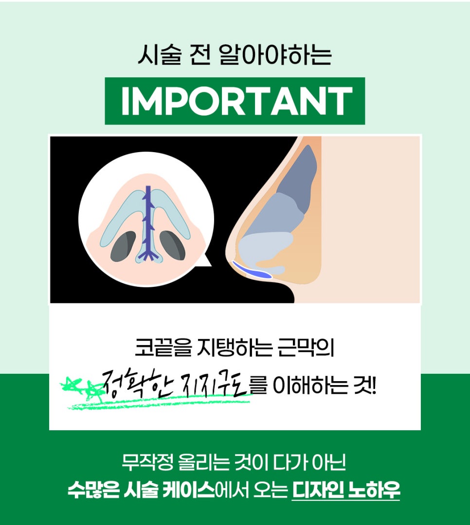코끝시술, 제이필 코끝창조로 더 높게! 관련 이미지 8
