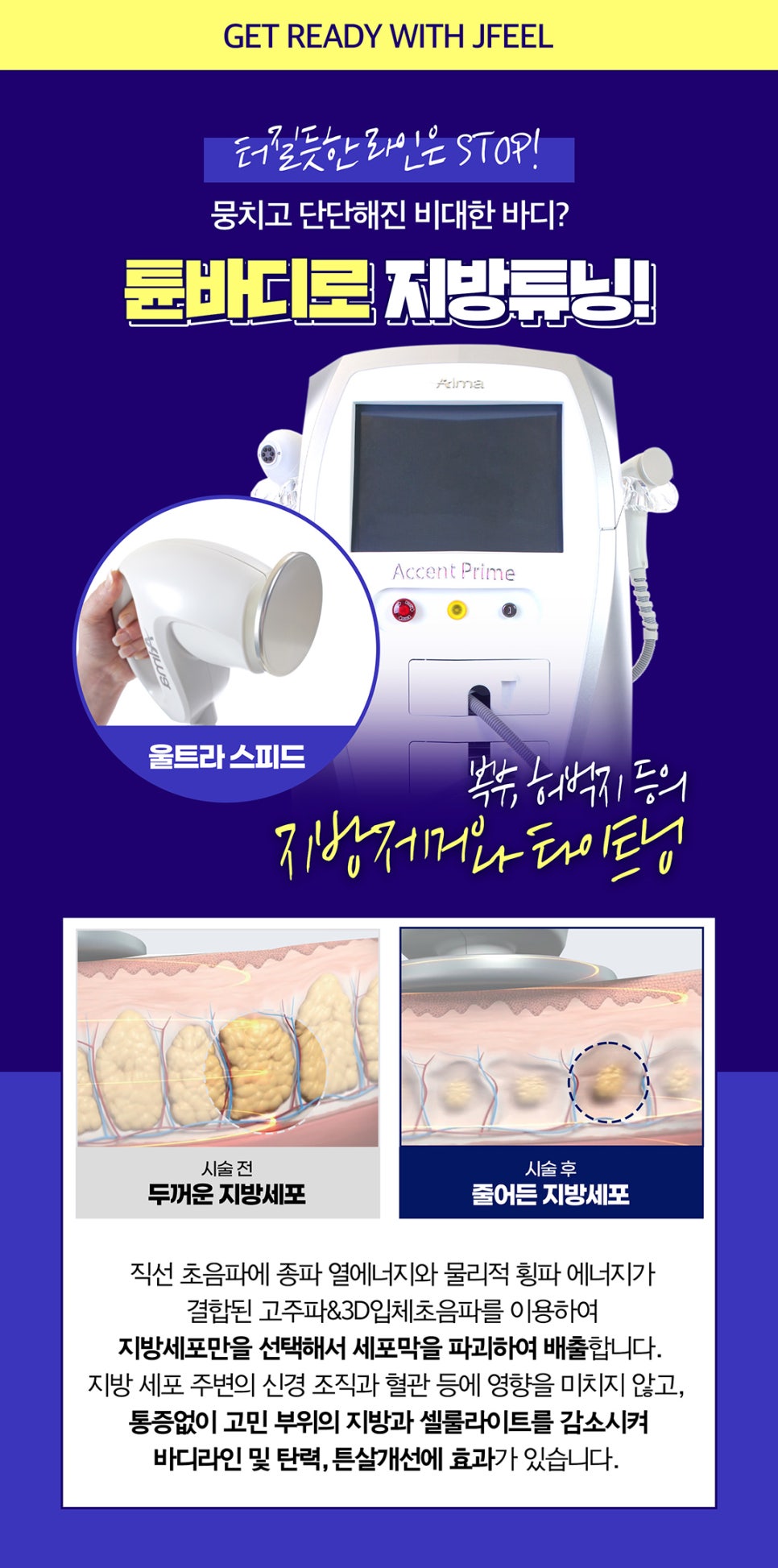 단기다이어트가 가능한 튠바디로 팔뚝, 뱃살 빼기 관련 이미지 2