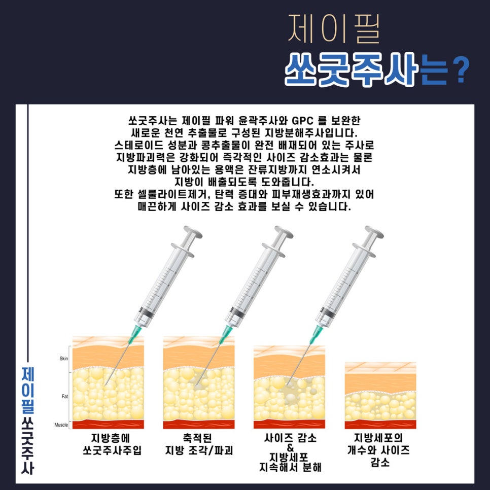 [홍대피부과] 옆광대도 이중턱도 제이필 홍대윤곽주사 관련 이미지 5