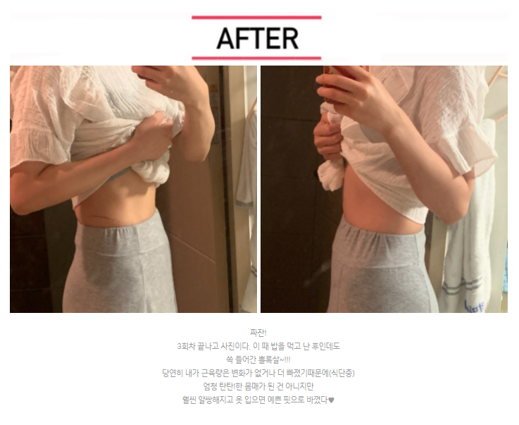 복부지방분해주사 리얼 후기! 효과와 성분도 따져보세요 관련 이미지 1