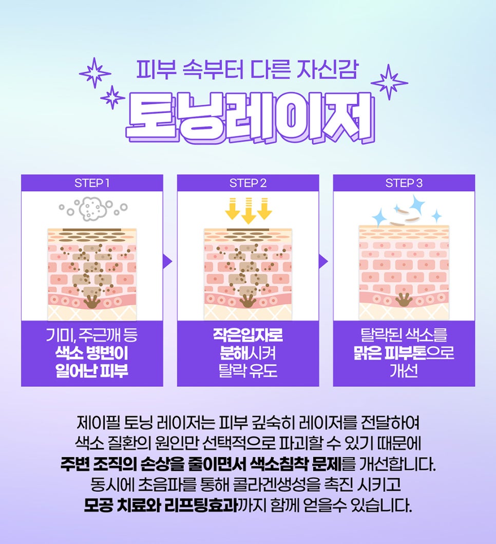 쥬베룩토닝, 토닝레이저+릴리이드+쥬베룩 효과 관련 이미지 3