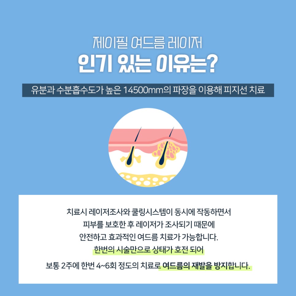 여드름과 흉터 개선에 도움을 주는 치료 방법 관련 이미지 10