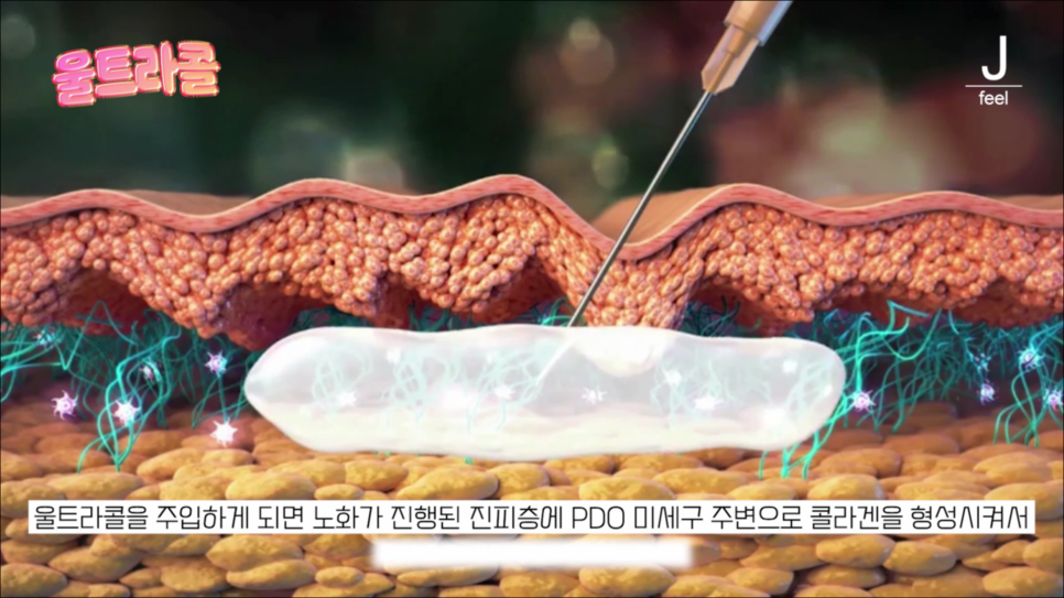 울트라콜 콜라겐 파워!! 콜라겐을 채워서 주름개선 효과까지! 관련 이미지 15