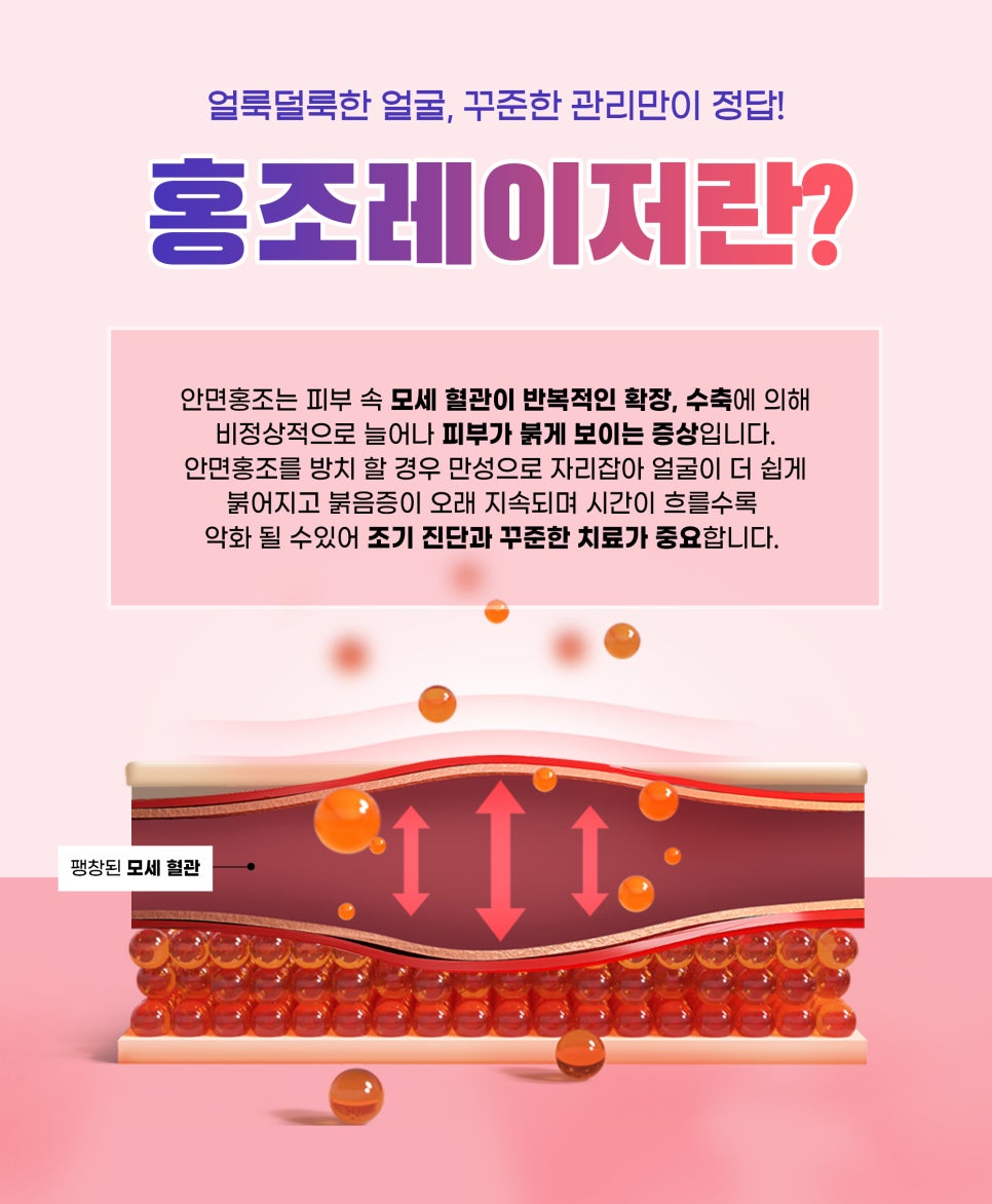 안면홍조 개선하고 싶다면? 관련 이미지 3