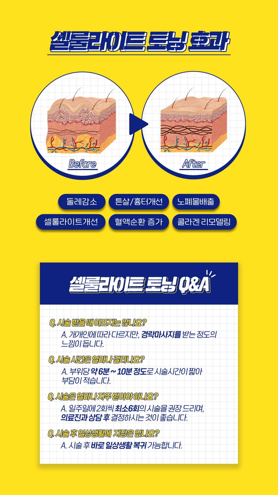 셀룰라이트 관리, 홍대피부과에서 추천드려요 관련 이미지 3