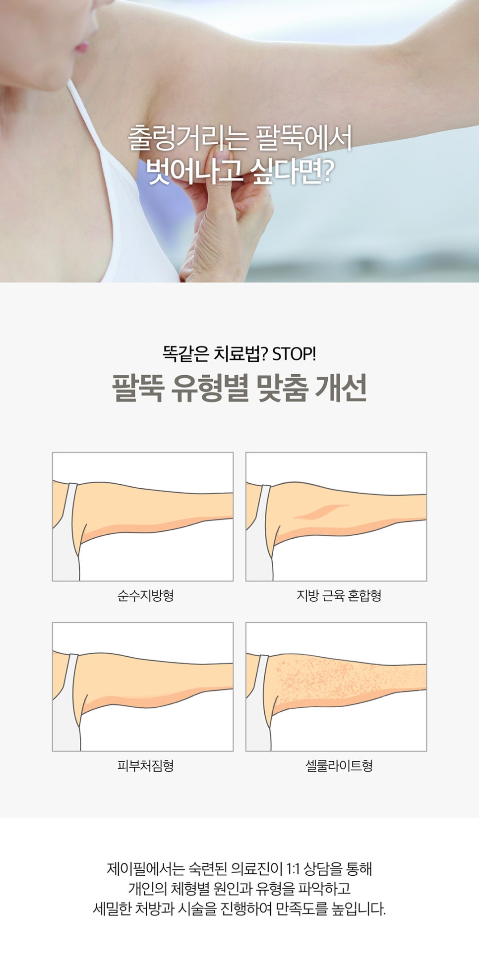 날씬한팔뚝만들기는 미세팔뚝주사 관련 이미지 2