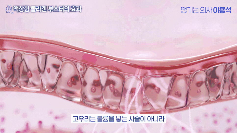 휴가 다녀왔더니 피부가 확 늙어 보인다? 여름철 피부관리 고우리 콜라겐부스터 관련 이미지 13